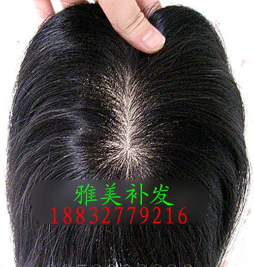 供應(yīng)滄州雅美植發(fā)、滄州哪里補(bǔ)發(fā)、滄州哪里賣假發(fā)、滄州定做假發(fā)、滄州假發(fā)廠、滄州假發(fā)套定做、滄州頭套