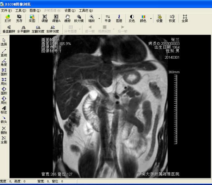 供应dicom工作站 x光机 CR DR CT MRI DSA工作站图片