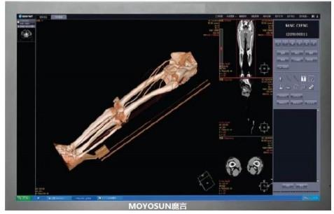 供应魔言42寸大屏显示器，CT显示器，X光机显示器PACS工作站，放射科看片