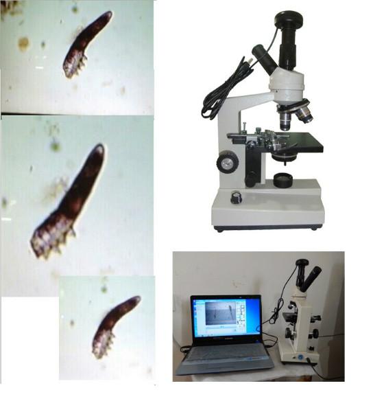 供应美容螨虫检测仪器显微镜/700/新怡