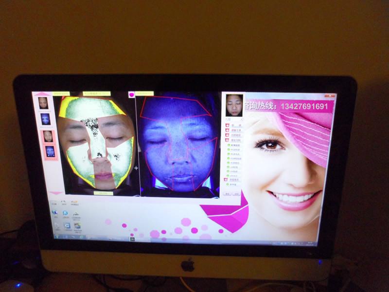 電腦魔鏡儀,面部CT皮膚分析系統(tǒng)圖片/電腦魔鏡儀,面部CT皮膚分析系統(tǒng)樣板圖 (3)