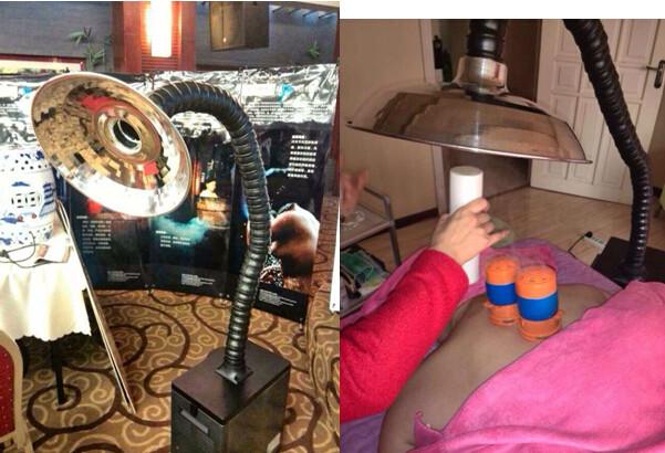 效果最好的艾灸除煙機圖片/效果最好的艾灸除煙機樣板圖 (2)