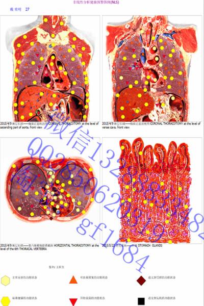 供应9D-CELL(MRA)生物讯息健康检测仪